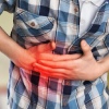Laparoscopy