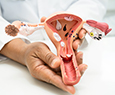 Cervical Cancer