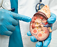 Kidney Cancer